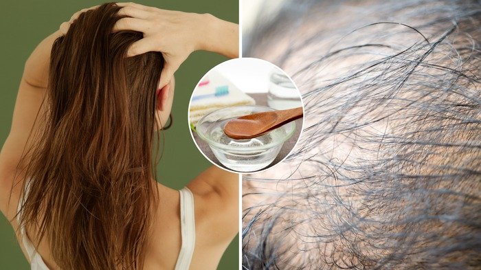 Even a bald head will grow hairs, apply this 10 rupees product || ଚନ୍ଦା ମୁଣ୍ଡରେ ବି ଉଠିବ ଚୁଟି, ଲଗାନ୍ତୁ ୧୦ଟଙ୍କାର ଏହି ଜିନିଷ