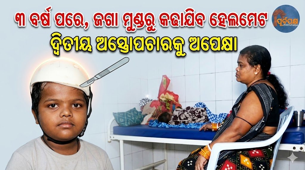 ୩ ବର୍ଷ ପରେ, ଜଗା ମୁଣ୍ଡରୁ କଢାଯିବ ହେଲମେଟ; ଦ୍ୱିତୀୟ ଅସ୍ତ୍ରୋପଚାରକୁ ଅପେକ୍ଷା || After 3 years, Jaga will have a helmet removed from his head; waiting for a second surgery
