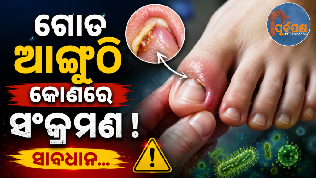 ଫଙ୍ଗଲ୍ ସଂକ୍ରମଣ ଟି.ବି. ଠାରୁ ୧୦ ଗୁଣ ଅଧିକ ବିପଜ୍ଜନକ : ସାଜିପାରେ ମୃତ୍ୟୁର ମୁଖ୍ୟ କାରଣ ! || Fungal infection 10 times more dangerous than TB: The leading cause of death in the world!